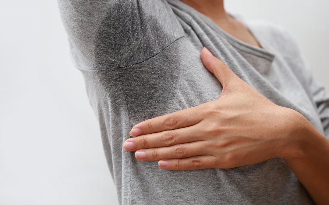 Botulinum Toxin Injections for Excess Underarm Sweating