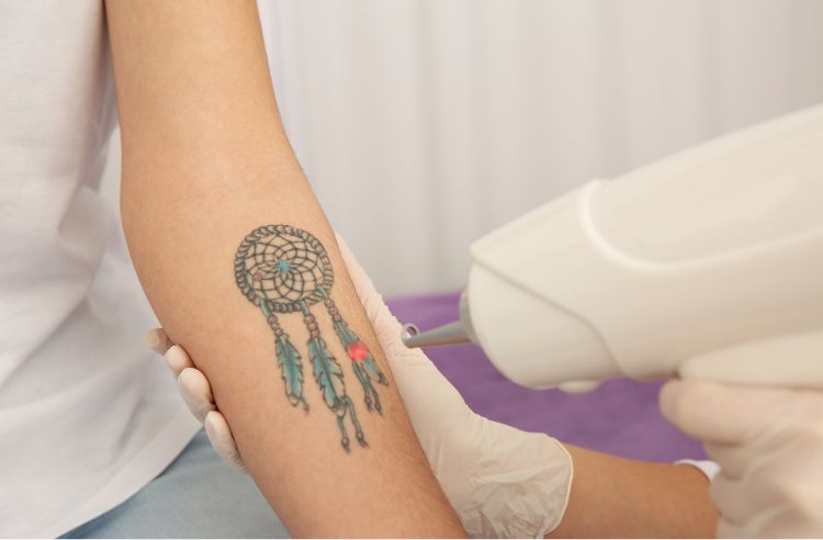 tattoo removal aftercare