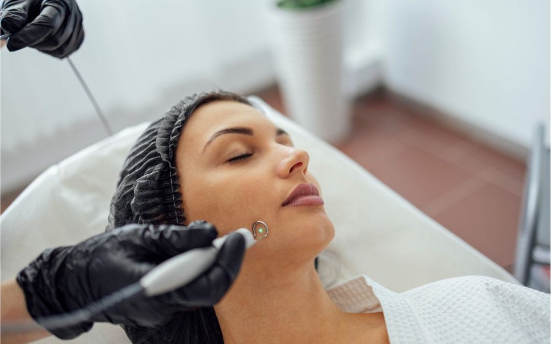 The Secrets of Private Wart Removal at PURE Holistic Beauty in Southampton