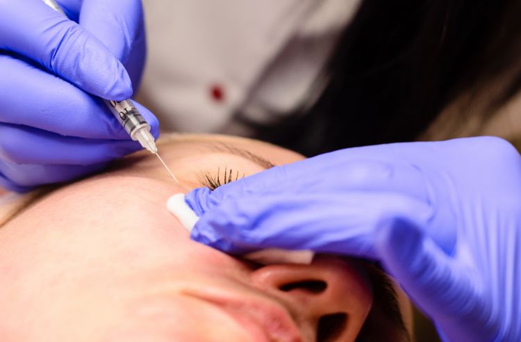 A Comprehensive Guide to Eyelid Skin Tag Removal