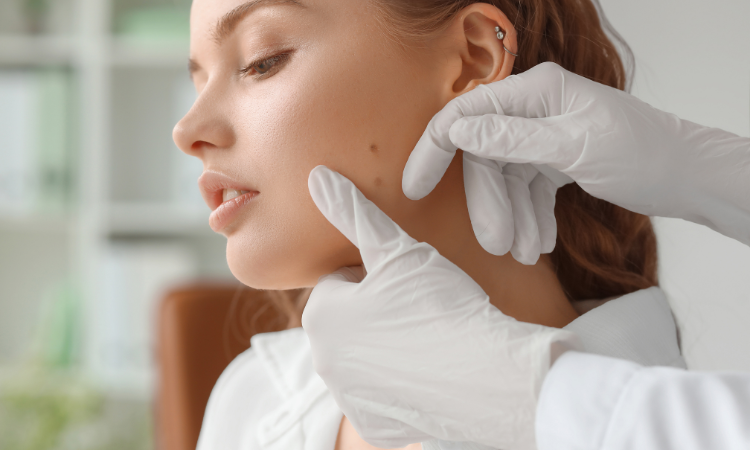 Blemish Removal with Advanced Electrolysis