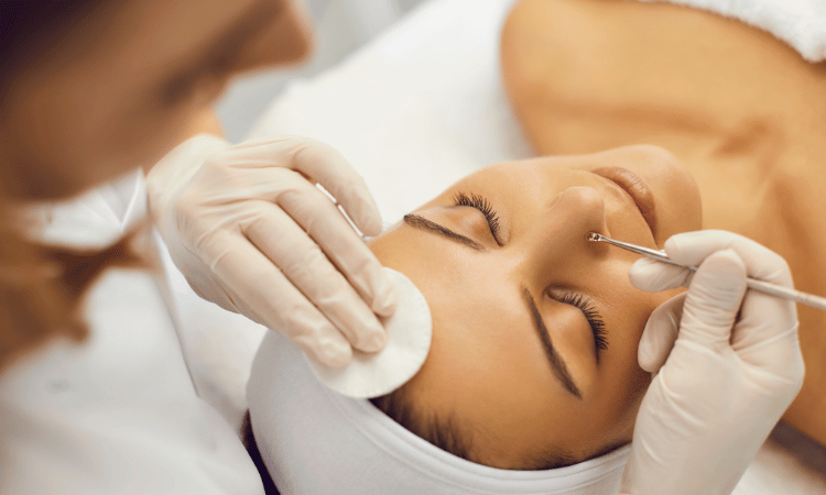 Expert Tips for Blemish Removal Aftercare